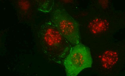 Stained cells showing BRCA1 in red and Cavin3 in green. Red and green coloured image of proteins